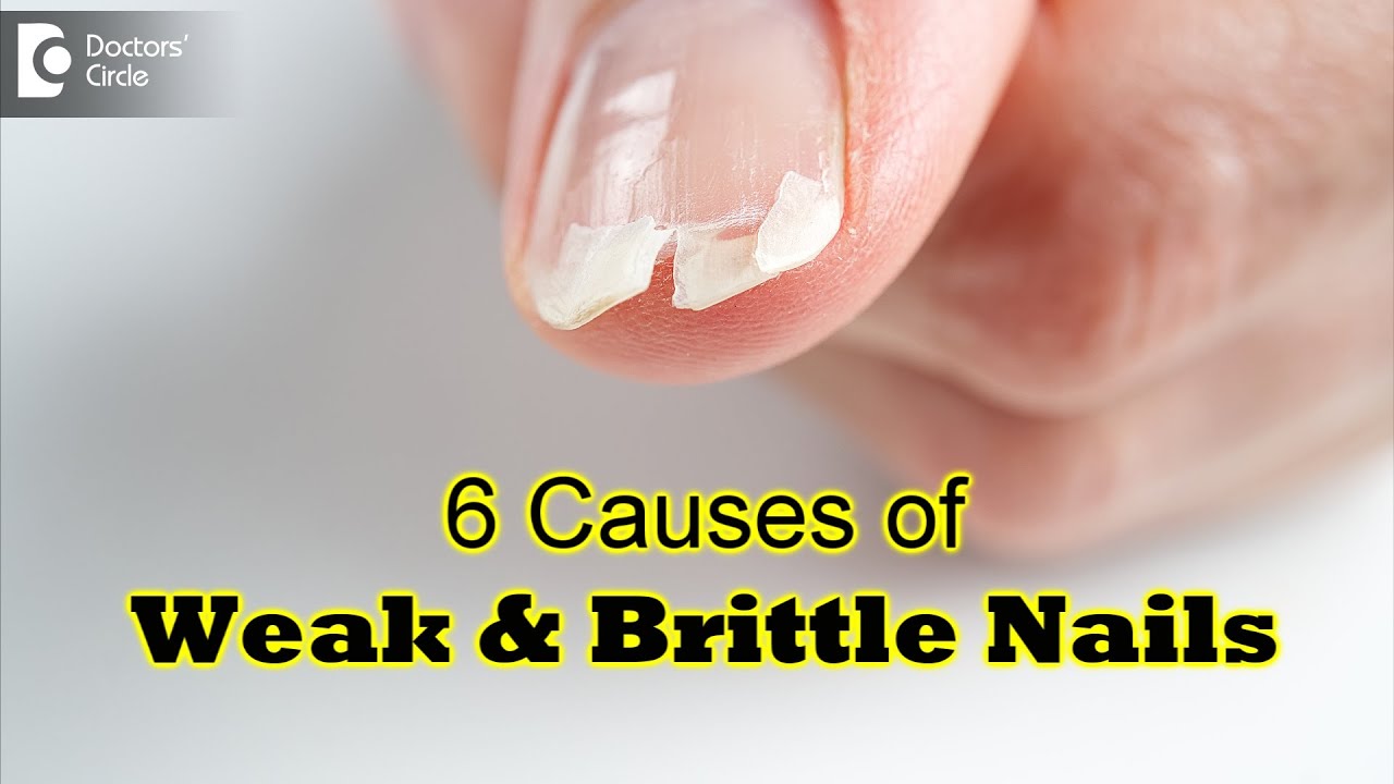 What Causes Yellow, Crumbly Nails?: Jennifer Tauber, DPM: Podiatrist